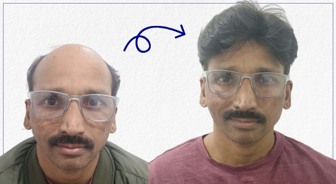 result-01