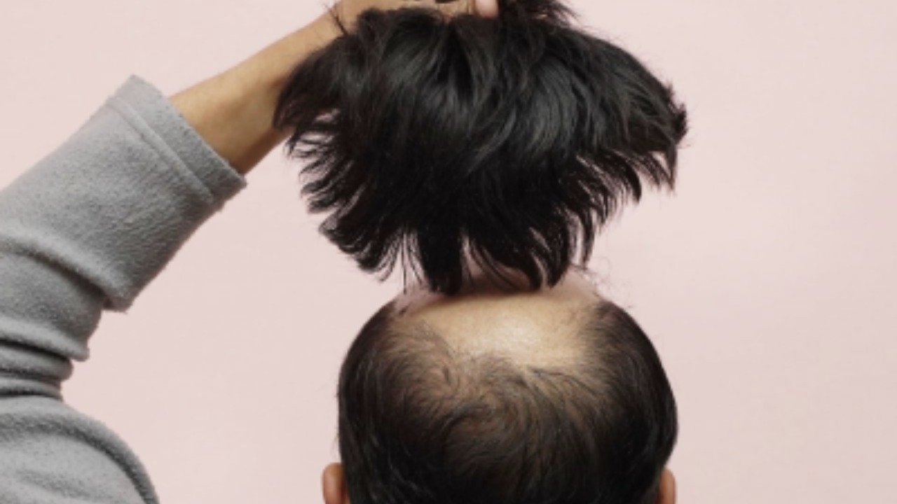 Hair Wig Image